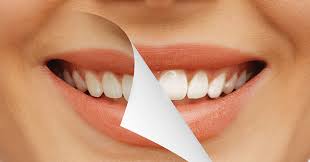 BRİLİYANT QAŞLAR DİŞİ ZƏDƏLƏYİR BRİLİYANT QAŞLAR DİŞİ ZƏDƏLƏYİR